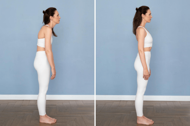 Posture Correction & Exercises
